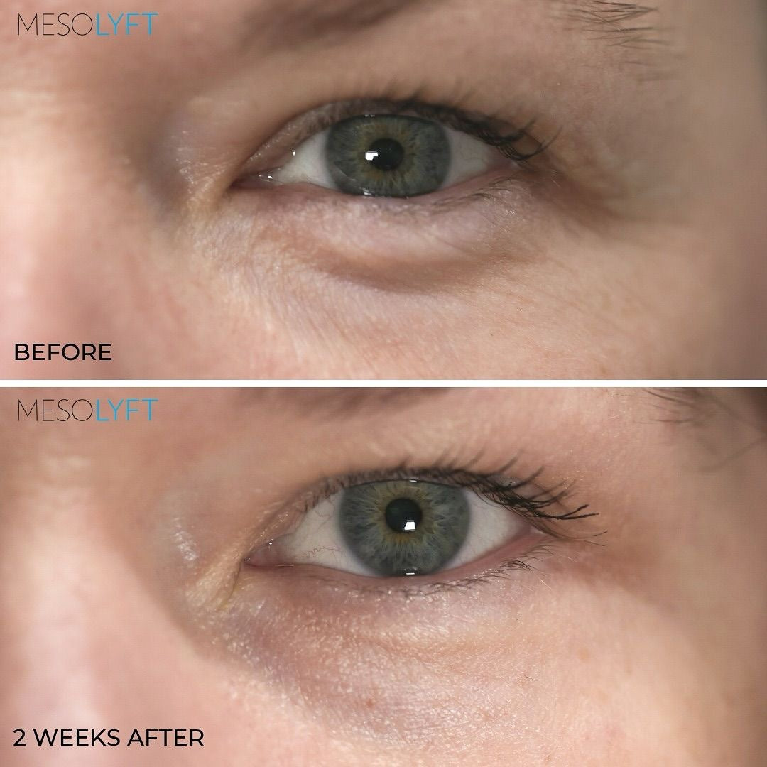 Vegan Collagen Eye Serum